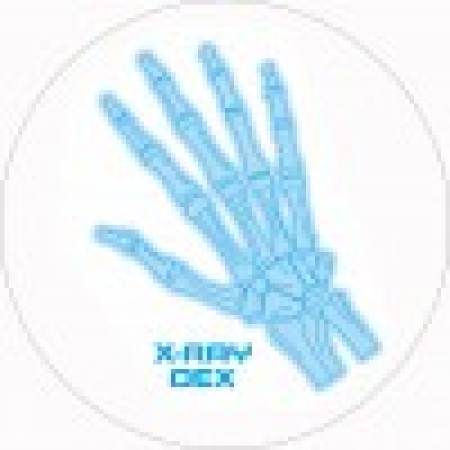Feltro X-Ray Dex Slipmat (Illuminous x2)
